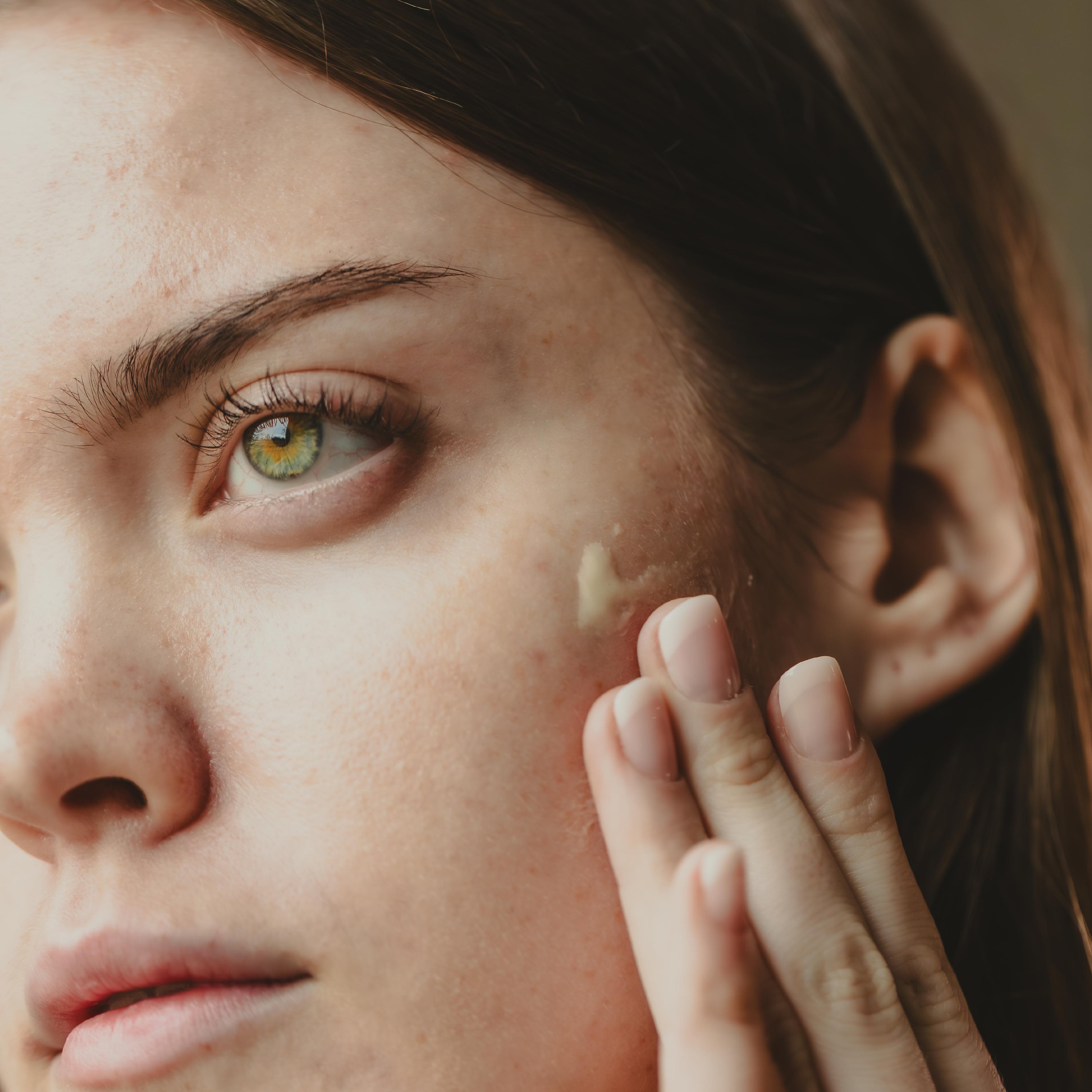 Clarifying Anti-Blemish Face Serum | 1 oz